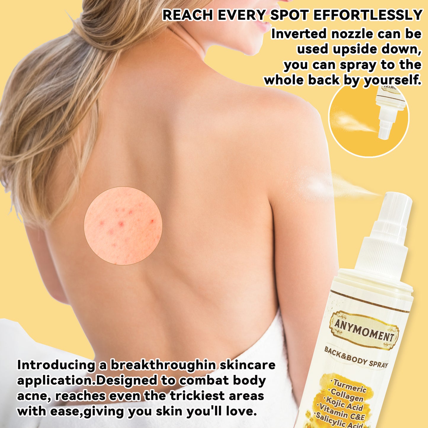 ANYMOMENT Turmeric Back & Body Spray for Dark Spot Removal - Enriched with turmeric, this gentle and non-irritating spray is perfect for caring for skin blemishes!